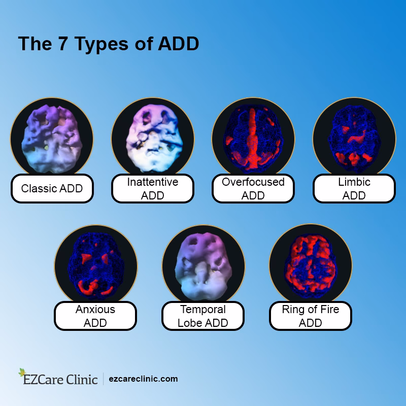 How do I treat ring of fire ADHD?