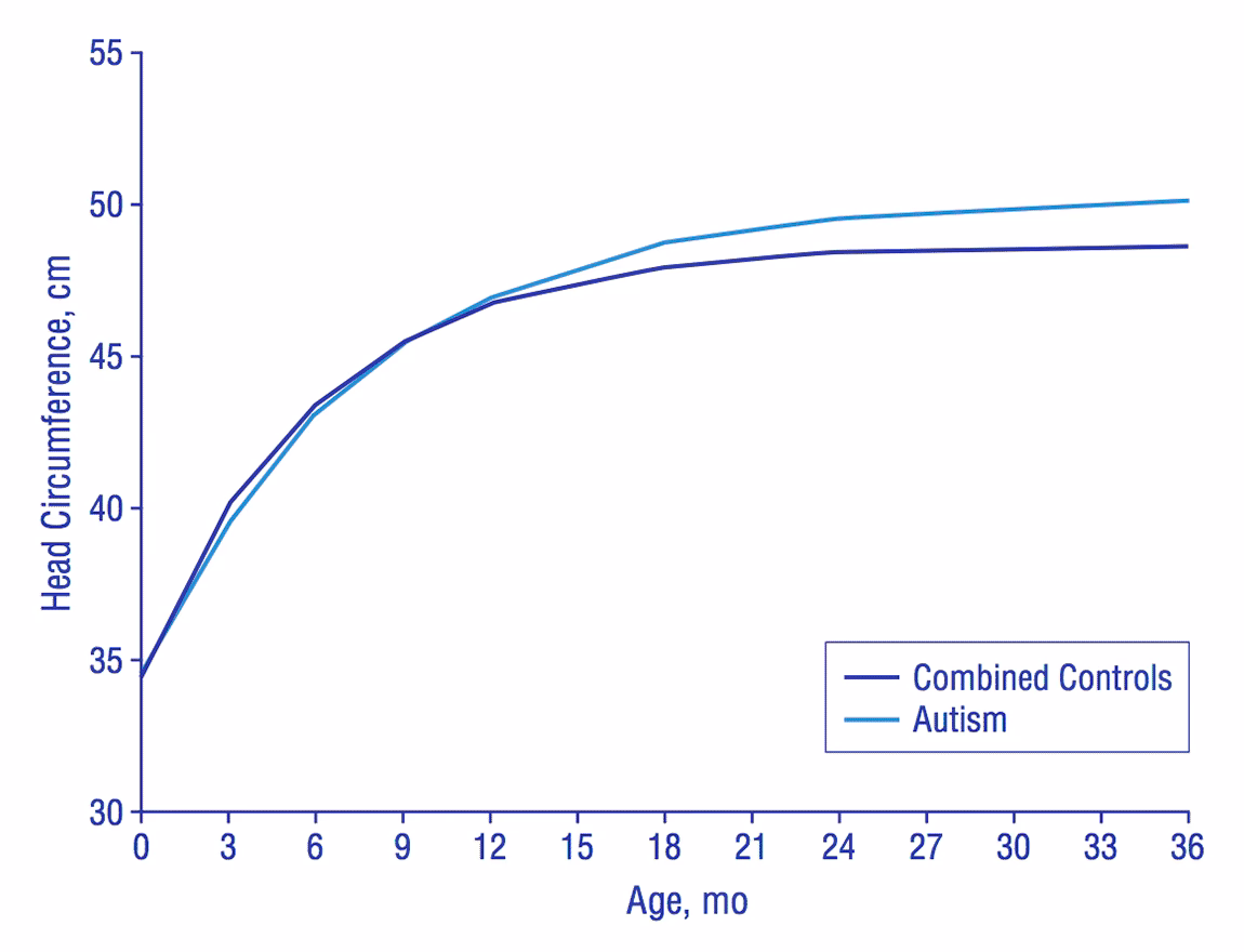 Is a larger head a sign of autism?
