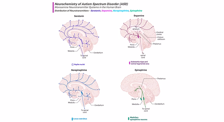 Do autistic people have altered dopamine levels?