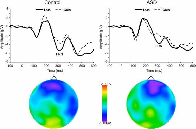 Does ASD affect social reward processing?