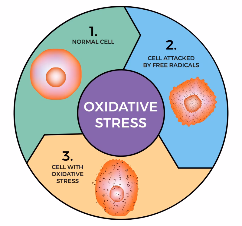Why is oxidative stress important?