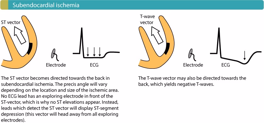 Which imaging tests can detect ischemia after exercise or pharmacologic stress?