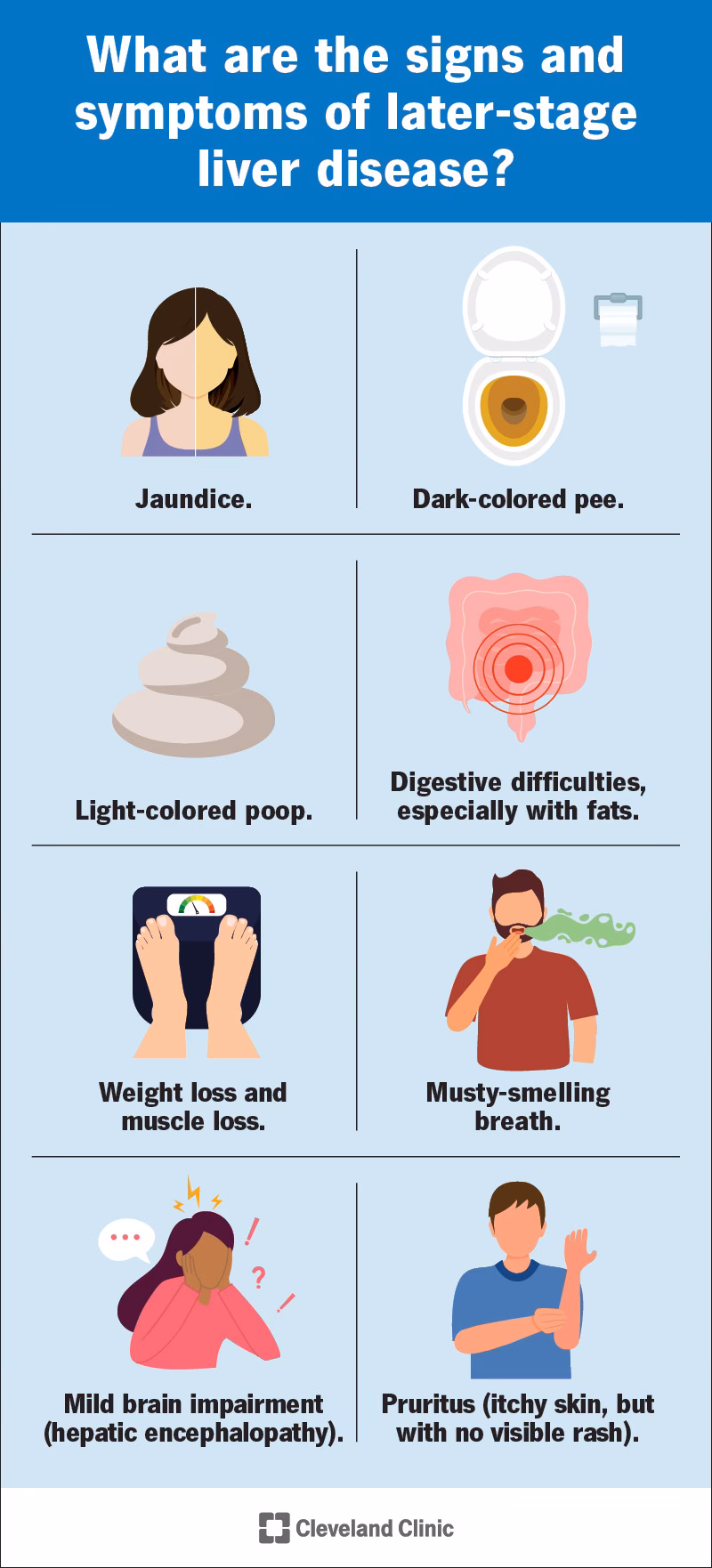 Can stress cause high liver enzyme levels?