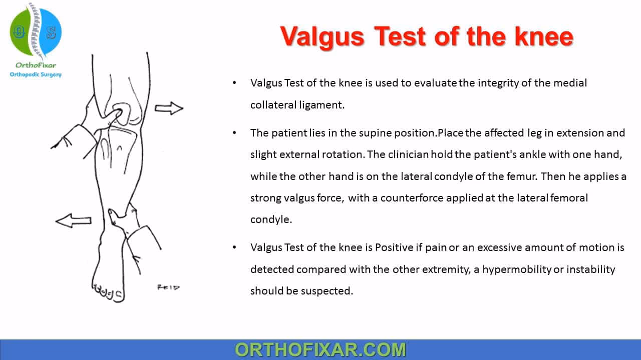 What is a valgus stress test?