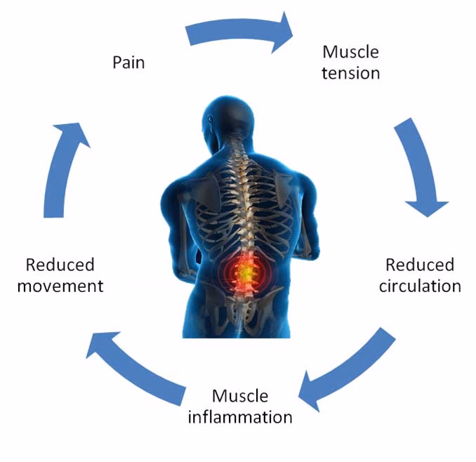 Why does my Back Hurt So much?