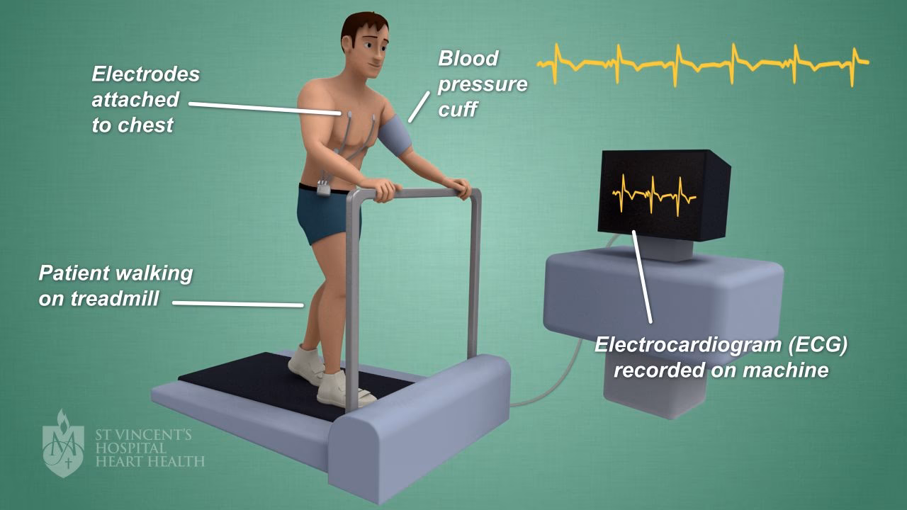 What happens during a stress test?