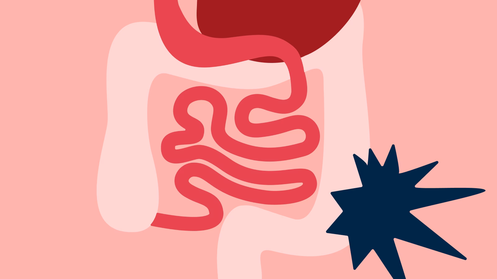 Quels sont les symptômes du stress digestif ?