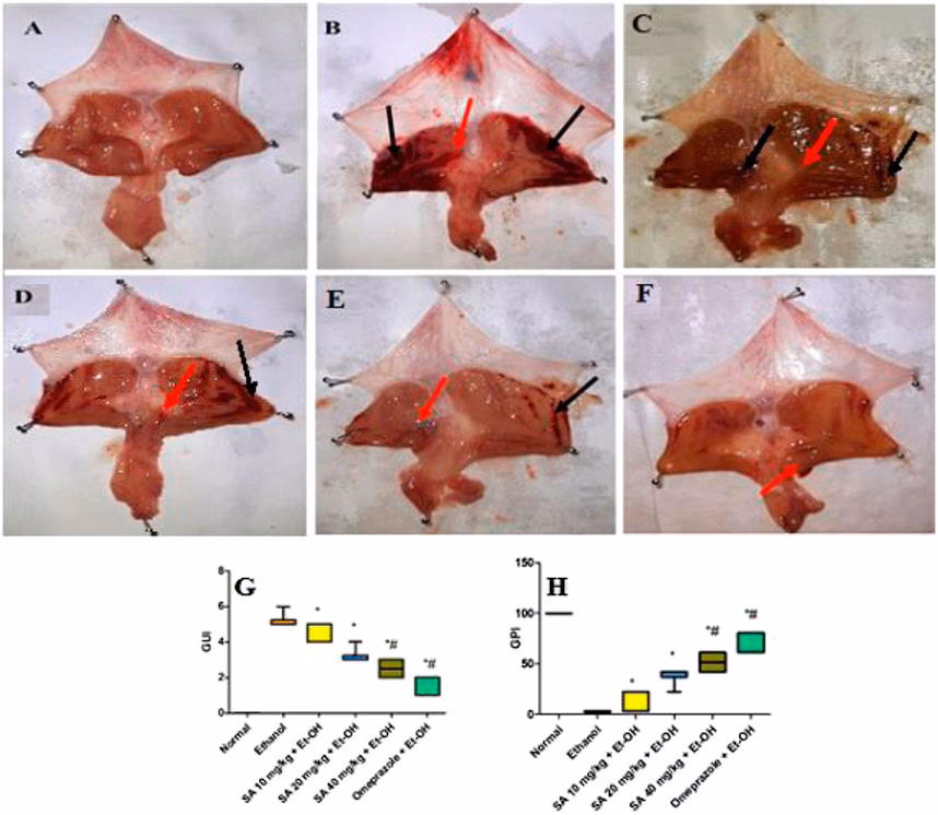 What are the most widely used rat models of acute gastric ulcer?