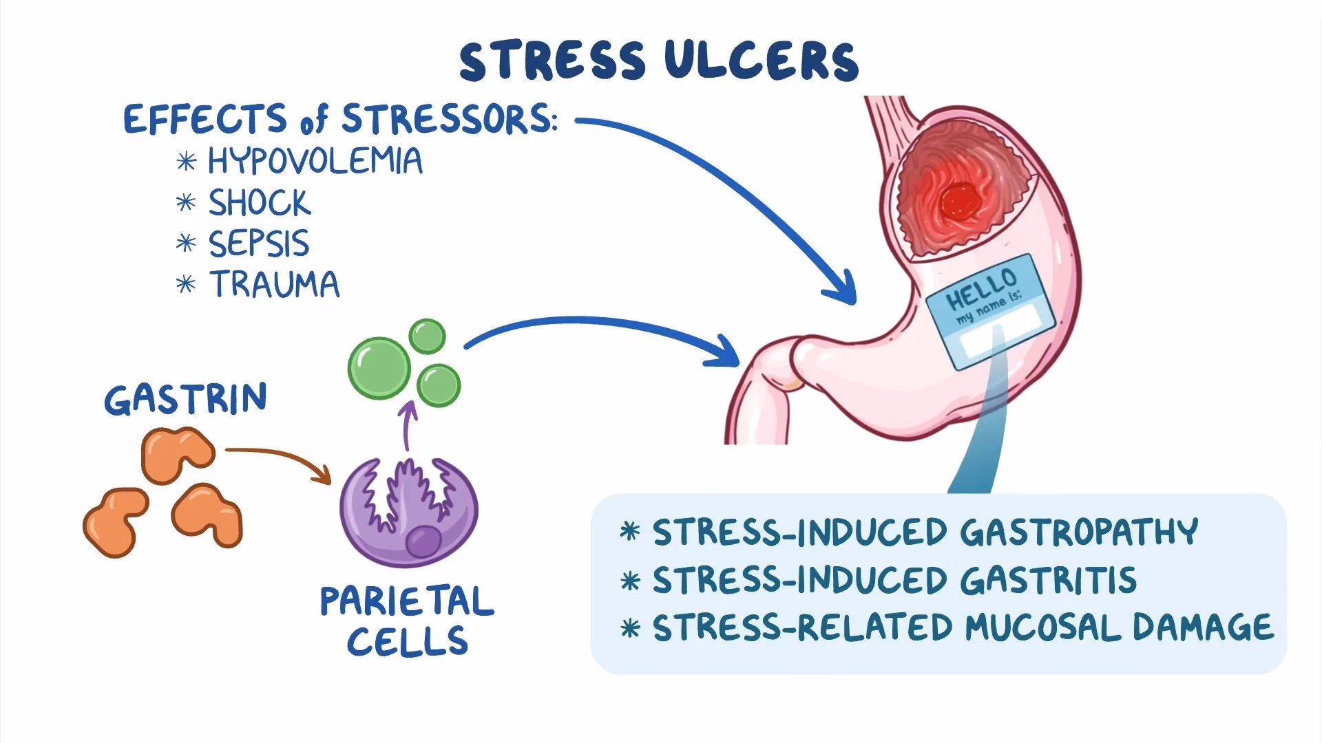 What is the treatment for stress ulcers?